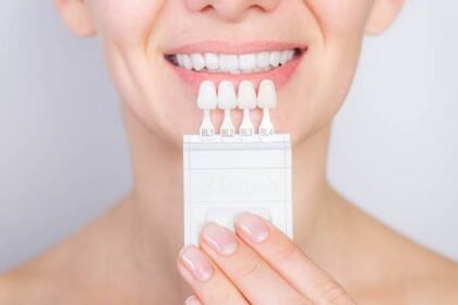 Can You Combine Veneers and Teeth Whitening Treatments?