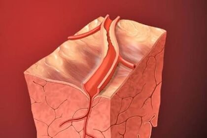 Causes of Chest Pain Beyond Heart Issues