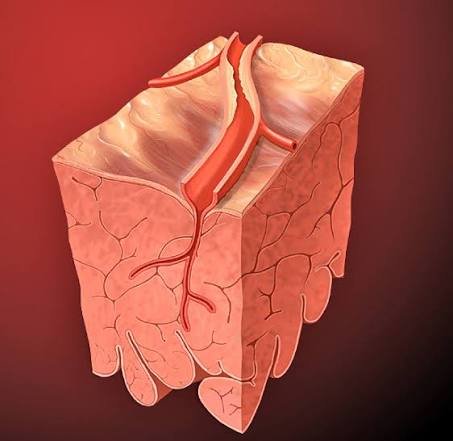 Causes of Chest Pain Beyond Heart Issues