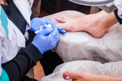 Coping With Ingrown Toenails