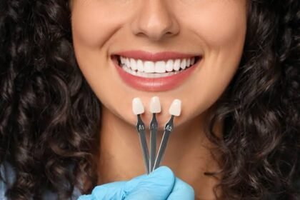 How To Prep for an Appointment To Get Porcelain Veneers