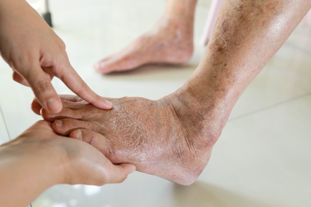 The Benefits of Regular Check-Ups With a Foot Doctor for Overall Health