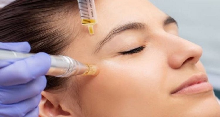 Understanding How Microneedling Works and Why It’s Effective
