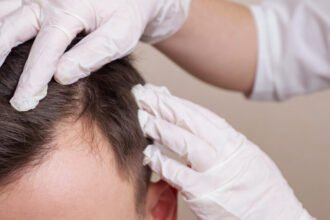 What Patients Should Expect During PRP Therapy