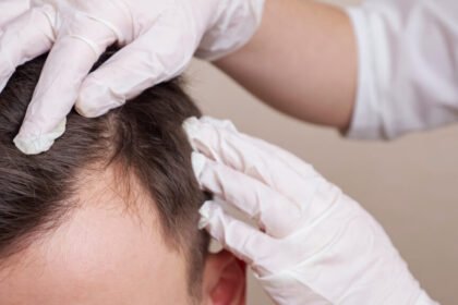 What Patients Should Expect During PRP Therapy