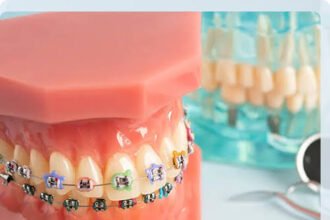 How Can I Tell If I Need Orthodontic Services?