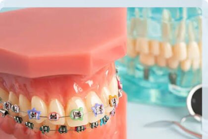 How Can I Tell If I Need Orthodontic Services?