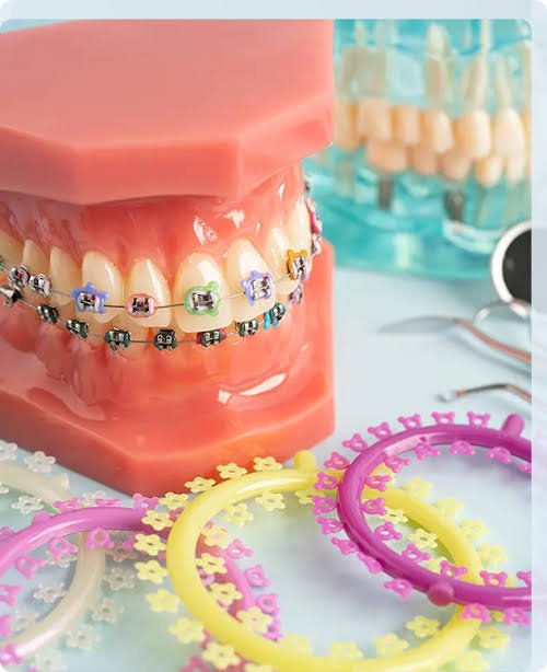 How Can I Tell If I Need Orthodontic Services?