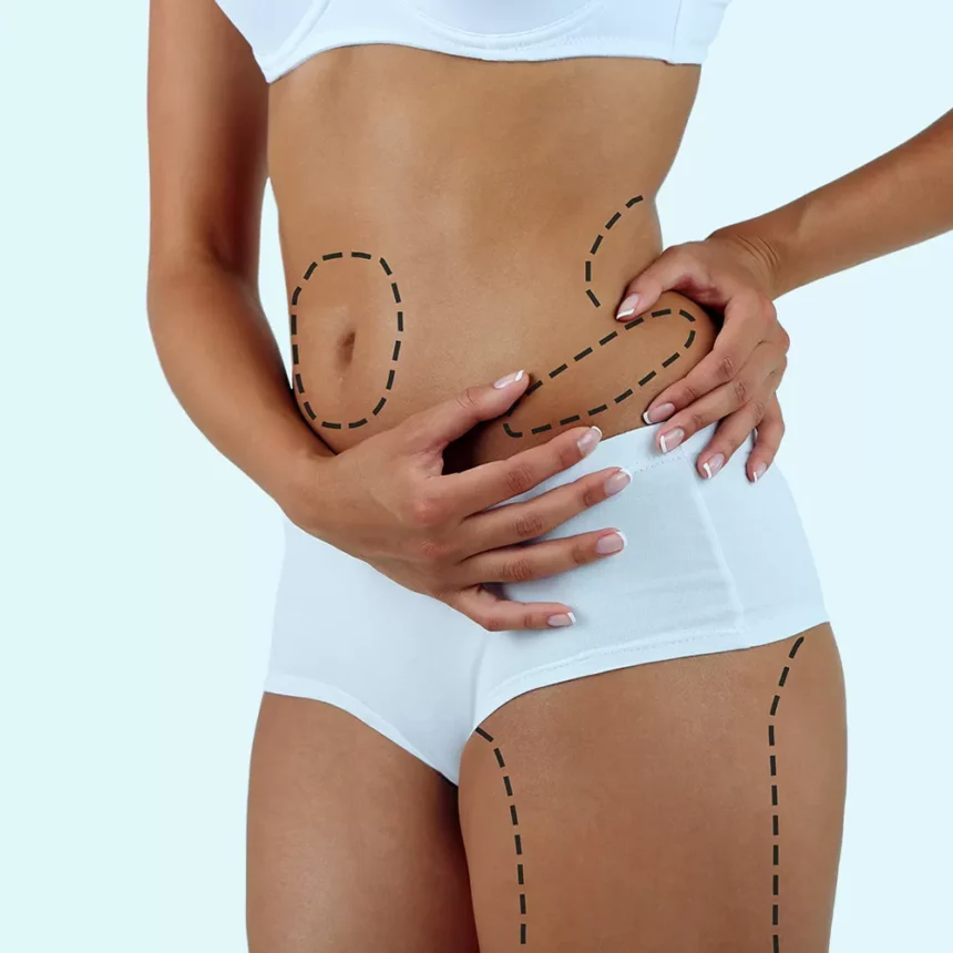 What to Expect During Your Liposuction Consultation