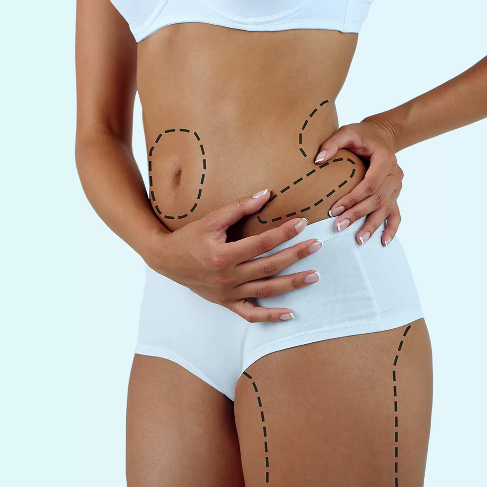 What to Expect During Your Liposuction Consultation